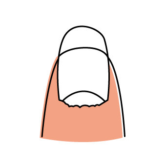 Cracked Cuticles Cracked Cuticles